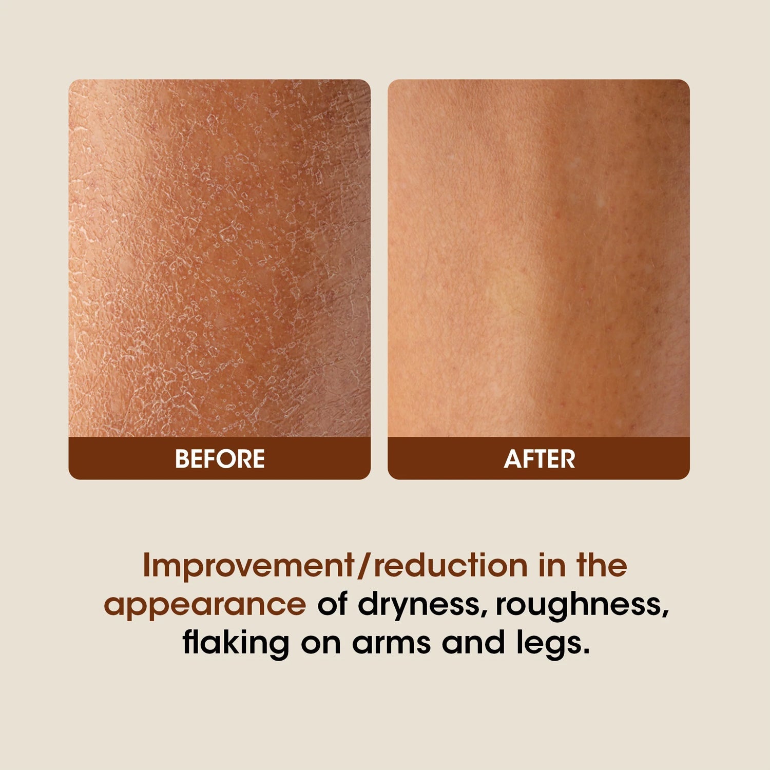 OG Beauty Science Cocoa Butter Body Lotion (350ML / 1 Pc) OG Beauty Science Cocoa Butter Body Lotion (350ML / 1 Pc)